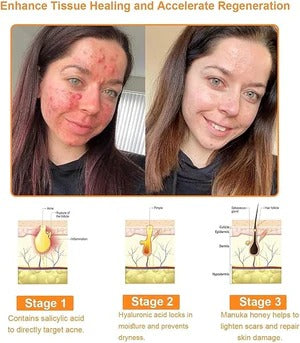 Bee Venom Cream for All Body Parts